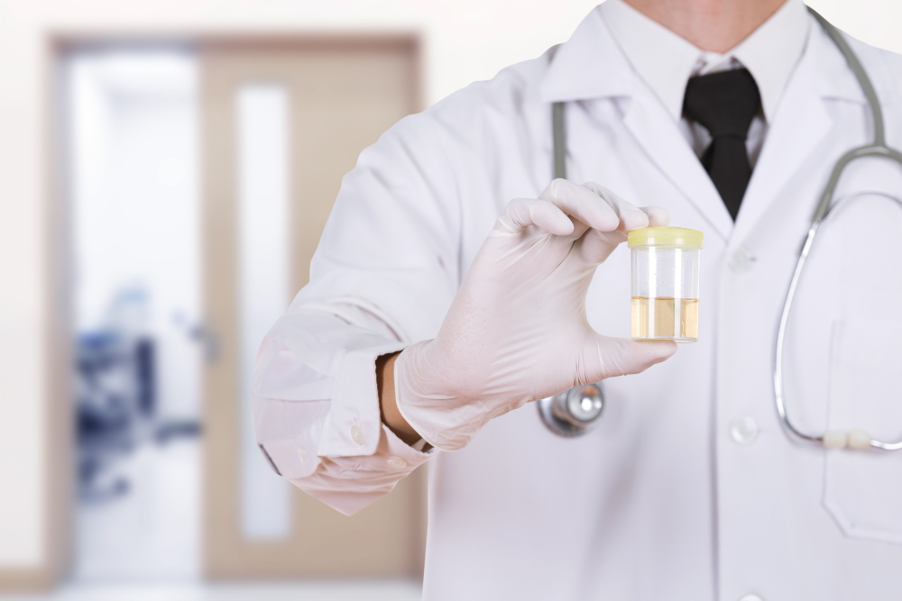 Urine Drug Test Detection Times Australia